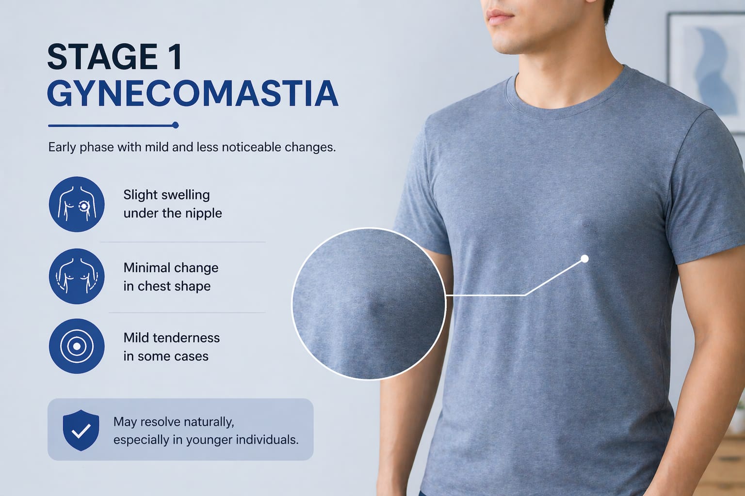 gynecomastia condition